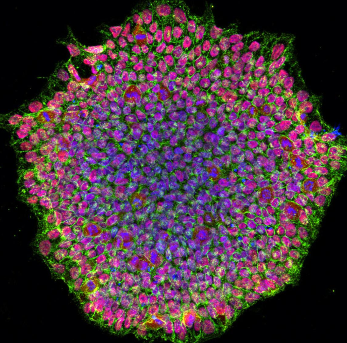 محققان NIH اولین مدل سلول‌های بنیادی آلبینیسم را برای مطالعه بیماری‌های چشمی مرتبط ایجاد کردند.